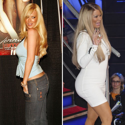 Celebrity booty implants – look at these shocking photos! – HOT NEWS