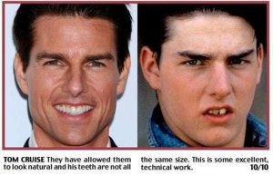 Tom Cruise